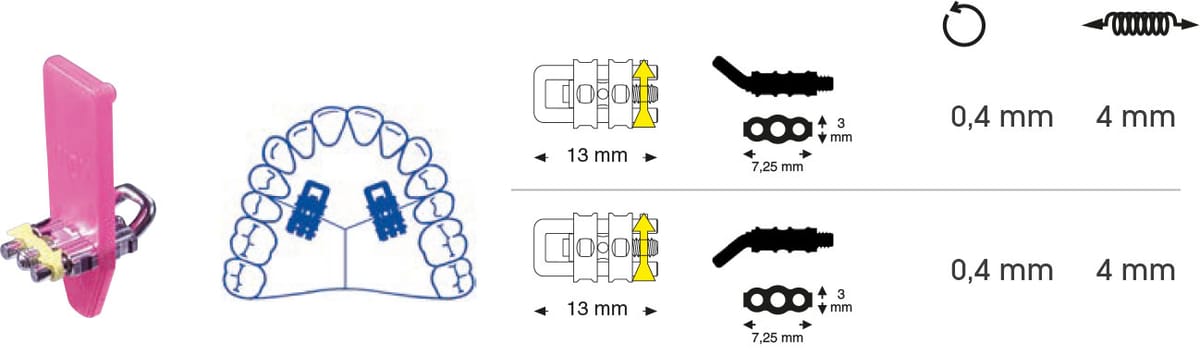 Micro vis sectorielle avec tige en U coudée – Orthobasics GmbH & Co. KG, Intraoral Appliances