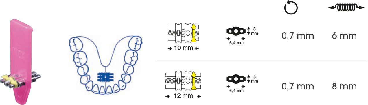 Mini Dehnschraube 12 mm – Orthobasics GmbH & Co. KG, Intraoral Appliances