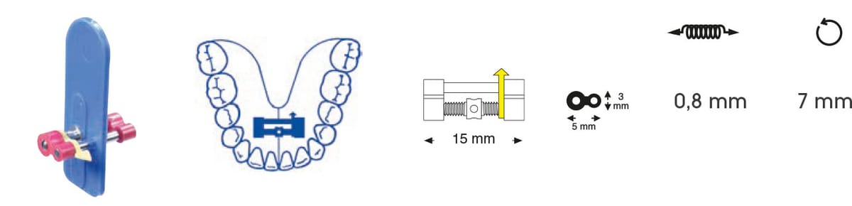 Friktionsdehnschraube für UK – Orthobasics GmbH & Co. KG, Intraoral Appliances