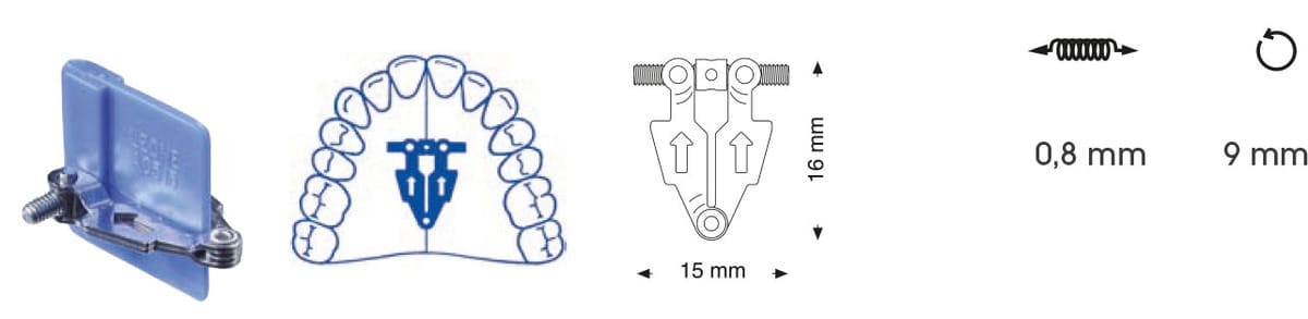 Vis d'expansion en éventail symétrique – Orthobasics GmbH & Co. KG, Intraoral Appliances