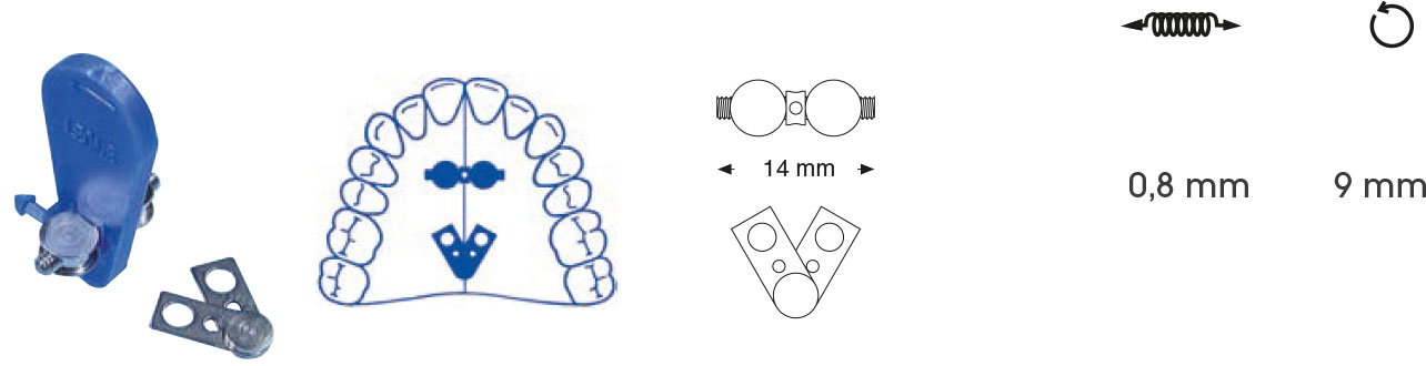 2-teilige Fächerdehnschraube für OK – Orthobasics GmbH & Co. KG, Intraoral Appliances