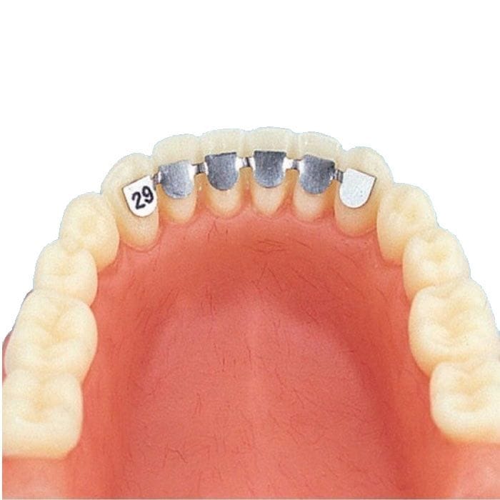 Contention collée canine à canine – Orthobasics GmbH & Co. KG, Orthodontics