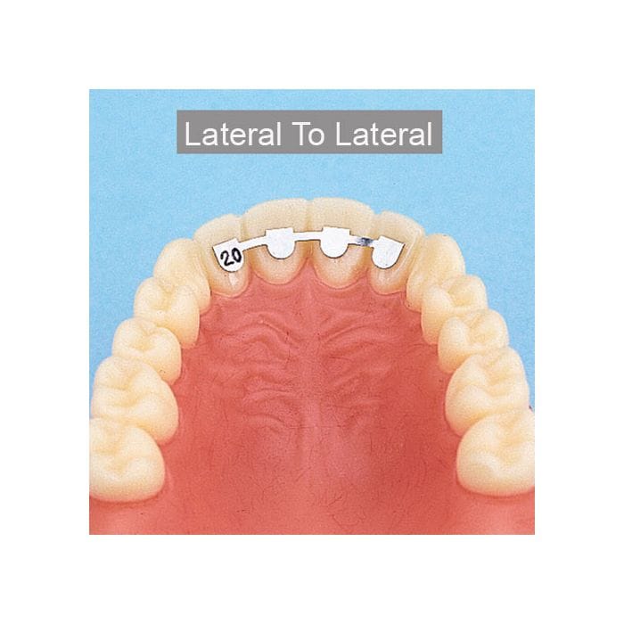 Retainer collé latéral à latéral, 18mm – Orthobasics GmbH & Co. KG, Orthodontics