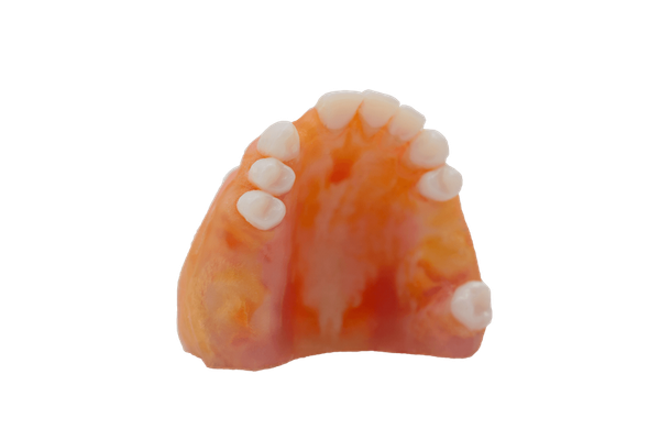 TrueJaw Implant Maxilla