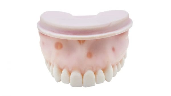 TrueJaw W/ Calcified Canal
