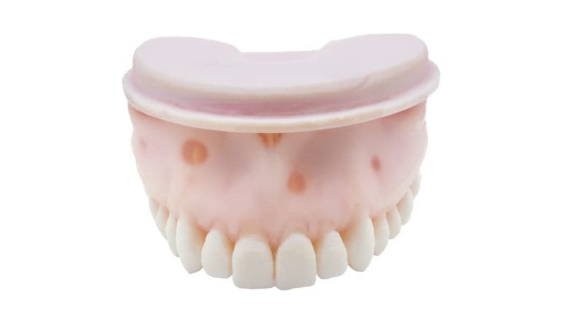 TrueJaw mit Kalzifiziertem Kanal – PlanB Dental, Keramikmassen