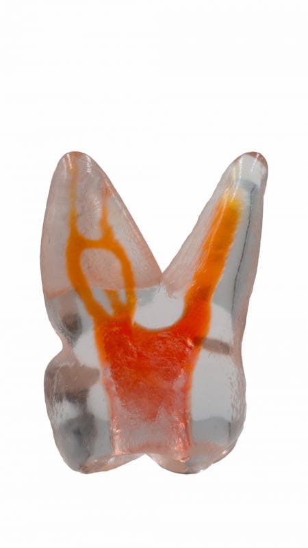 TrueTooth - Molar – PlanB Dental, Printing Resins