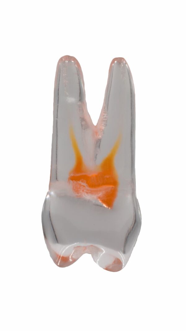 TrueTooth - Pre-Molar – PlanB Dental, Die & Model Materials