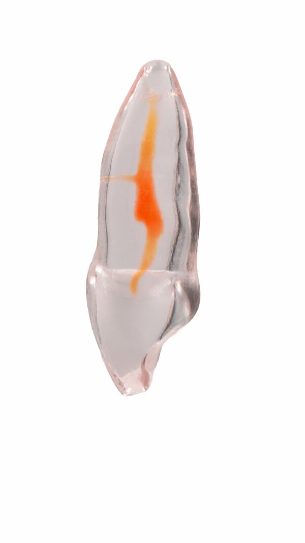 TrueTooth - Anterior – PlanB Dental, Die & Model Materials