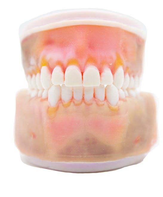 TrueJaw Endo Surgery – PlanB Dental, Gypsum Additives, Die Hardeners and Plaster Removers