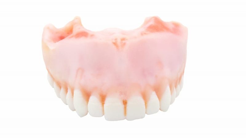 TrueJaw Extraction Maxillaire – PlanB Dental