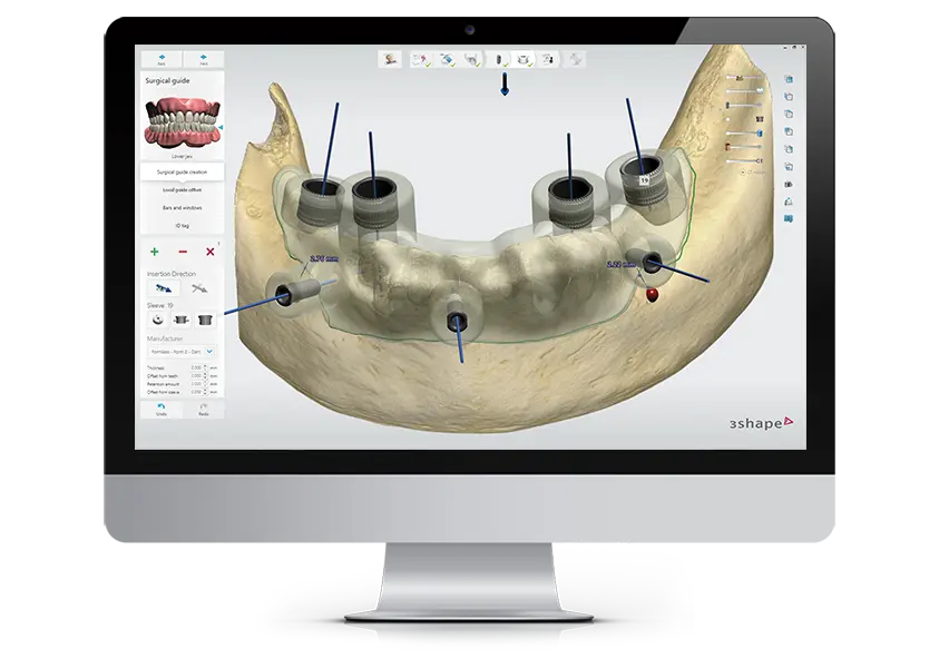 3Shape Implant Studio – RS-TEAM S.C., CAD/CAM-Software