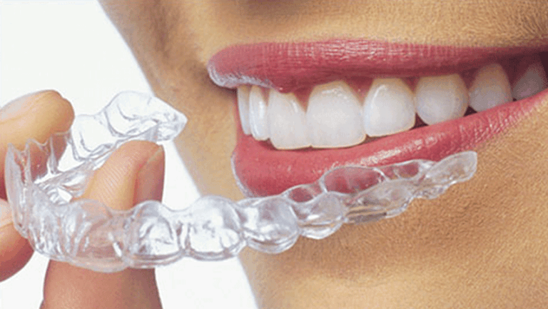 P223 PRO – Láminas para alineadores Sabilex Align Multilayer