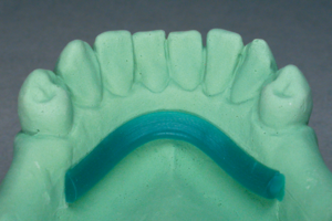 WaxStar Lingual Bar