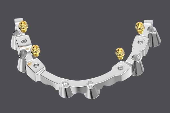 Stege & Suprastrukturen – seramicCAM Europa GmbH, Implant Components & Abutments