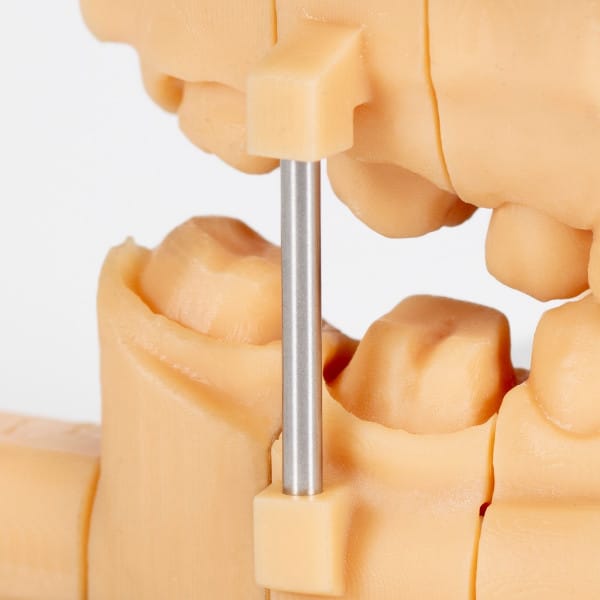 Artikulationsstützen – Baumann Dental, Artikulatoren und Zubehör