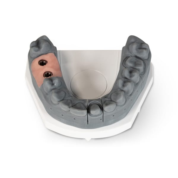 Gingivamaske Grundeinheit (bis 3 verbundene Zähne) – Baumann Dental, Temporary Crowns