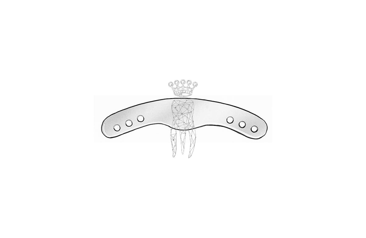 Matrizenband Ivory 12 Stück – Carl Martin, Matrix Bands