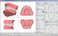 OnyxCeph³™ module V.T.O.3D (Virtual Treatment Objective) 410-000-07