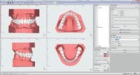 OnyxCeph³™ module Retainer 3D 410-000-10