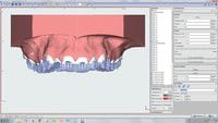 OnyxCeph³™ module Bonding Trays 3D 410-000-11