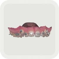TRIOS Orthodontic Planner app 420-200-03