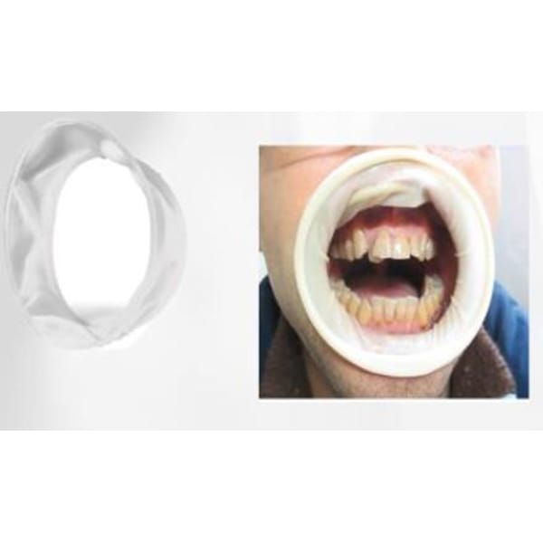 Rubber Mouth Gap (sterilized by EO) AO10402 – Shanghai Ristea Industries Co., Ltd, Other Surgical Instruments