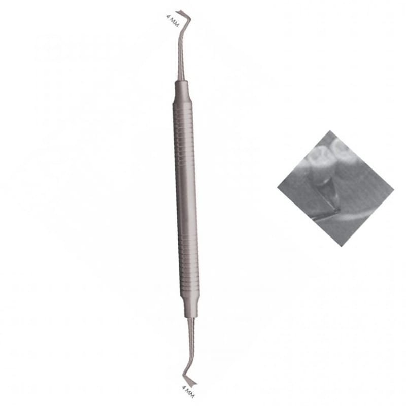 Gingival Precision: 4mm Retractor for Enhanced Dental Procedures – Absolute Sport Srl Skeema Dental Italia, Retraktionsfäden / -ringe
