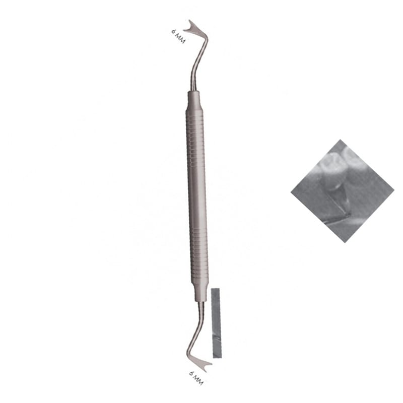 Gingival Precision: 6mm Retractor for Dental Professionals' Accuracy – Absolute Sport Srl Skeema Dental Italia, Retraktionsfäden / -ringe