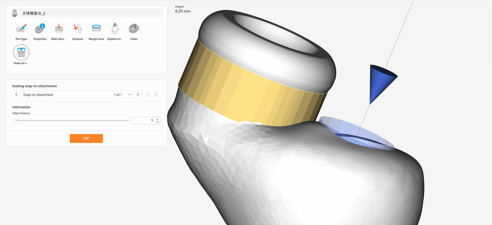 hyperDENT – Kocharyan Digital Dentistry, CAD/CAM Software