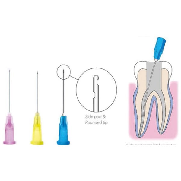 Dental Endo Irrigation Needle Tips (Dual-sides notched, closed-end, round tip, 1")