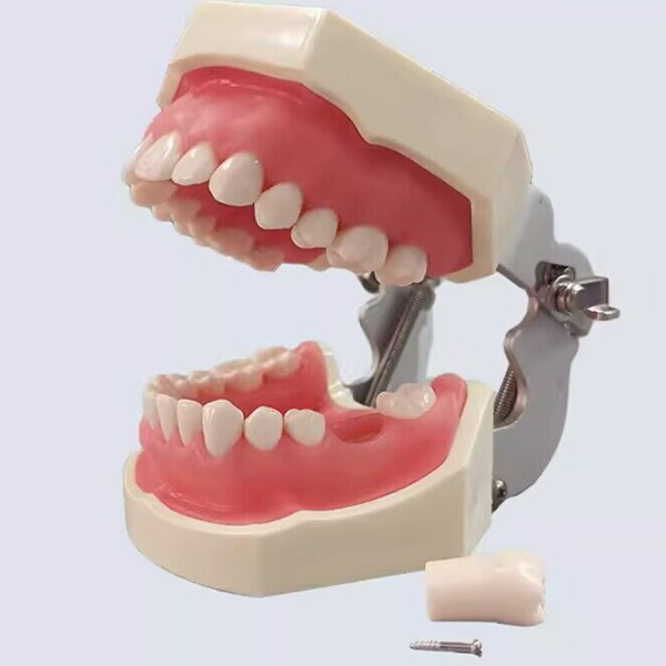 Standard Model with 28 Screw-in Teeth