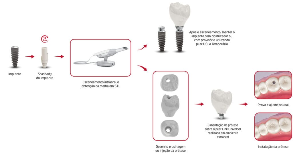 Konisches Abutment 20° – A. S. Technology Components Especia Especiais Ltda. TitaniumFix, Implantologie