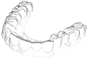 Smilemaker Clear Aligner Printer