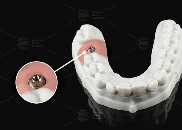Silver Gold Titanium Multi Unit Abutment For Single Or Multi Unit Prosthetic Platform