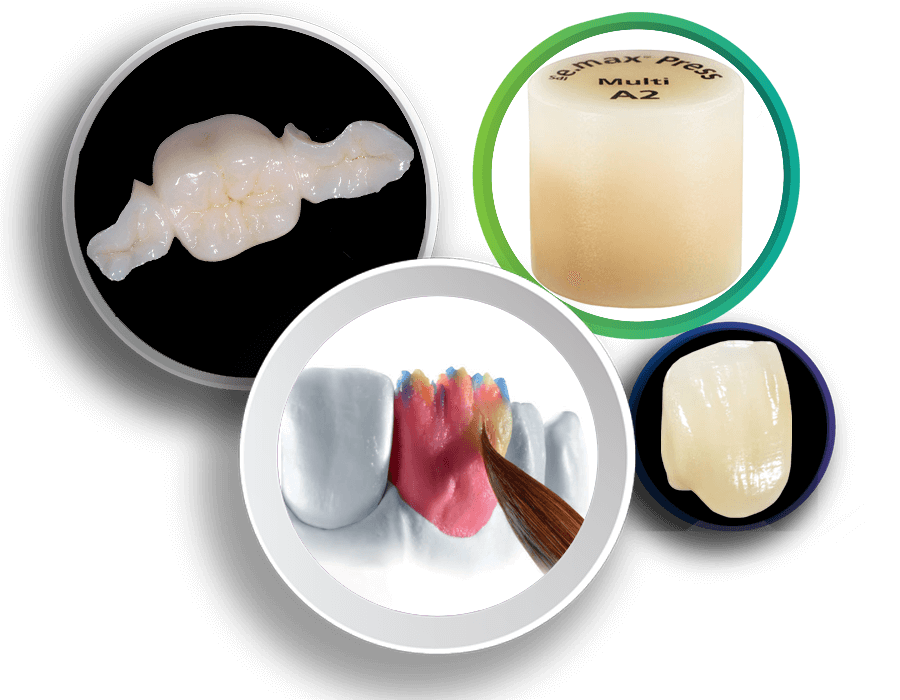 ADE E-Max: Aesthetic Maxima IPS Emax Crowns & Veneers – Advance Dental Export, Preformed Crowns