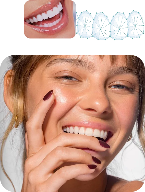 Advance Zirconia pour dents et prothèses dentaires sans métal – Advance Dental Export, Temporary Crowns