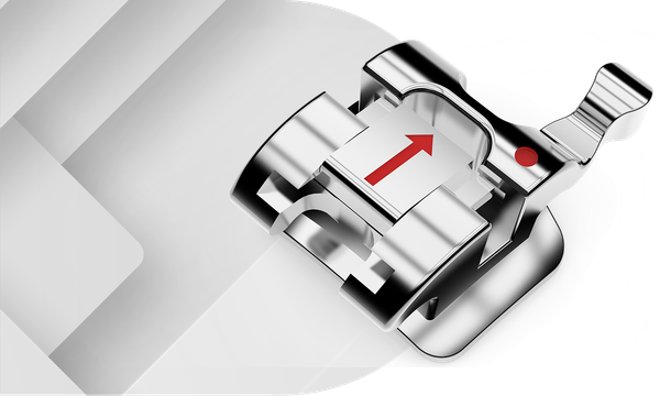 Bracket Self-ligating Queen