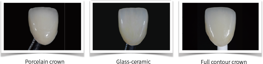 Aidite Stain/Glaze – Aidite (Qinhuangdao) Technology Co. Ltd, Ceramic Materials