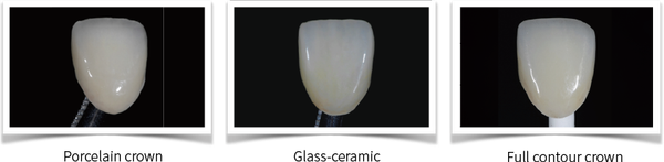 Aidite Stain/Glaze
