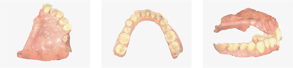 Aidite Cameo Rapid 3 – Aidite (Qinhuangdao) Technology Co. Ltd, Intraoral Scanners