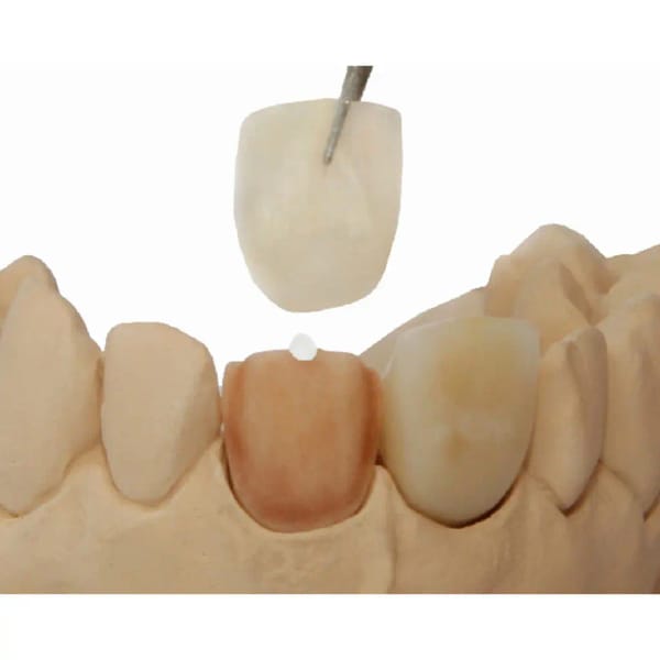 GLUFI - temporary CAD/CAM fixation material, 5 ml