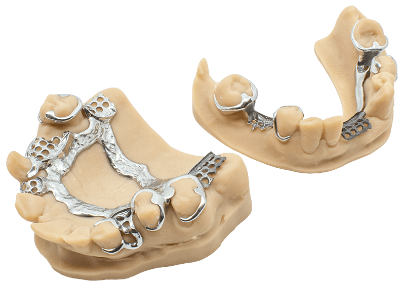 SLM Klammermodellguss – CADstar Technology GmbH, Acrylic Resins
