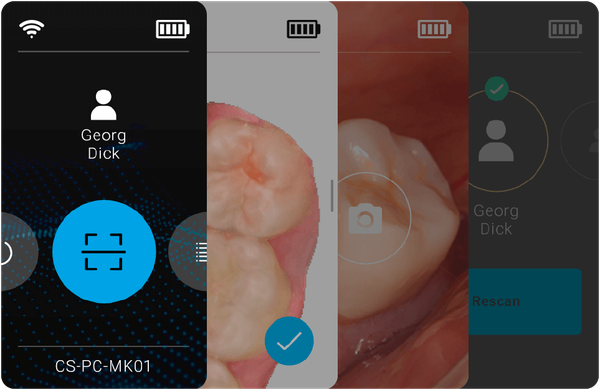CS.Nova Intraoralscanner