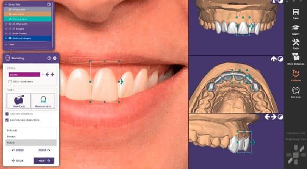 Chairside Smile Creator module