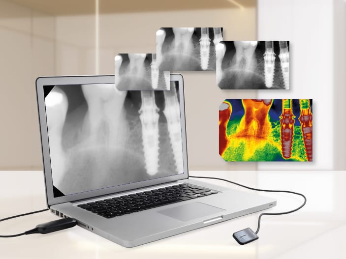 Sensori odontoiatrici intraorali Castellini – Castellini, X-ray