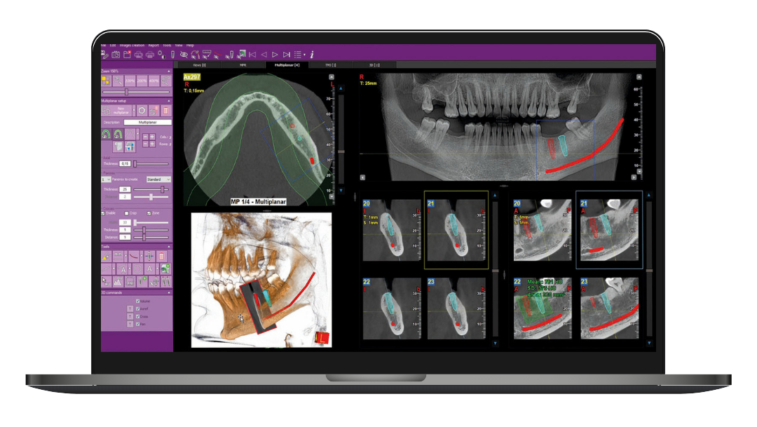 iRYS – Castellini, CAD/CAM-Software