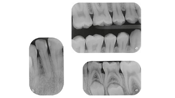 VistaScan Nano Easy – DÜRR DENTAL, Speicherfolienscanner