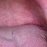 SNORE3