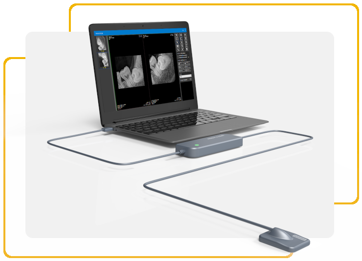 Evolve - RX Sensor – Evolve Technology, X-ray